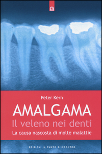 Amalgama. Il veleno nei denti. La causa nascosta di molte malattie