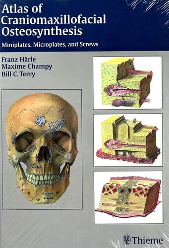 Atlas of Craniomaxillofacial Osteosynthesis: Miniplates, Microplates, and Screws
