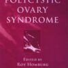 Polycystic Ovary Syndrome