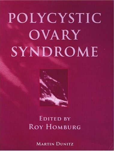 Polycystic Ovary Syndrome