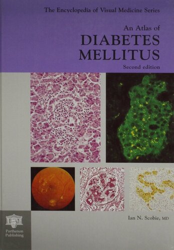 An Atlas of Diabetes Mellitus, Second Edition