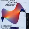 Customized Corneal Ablation: The Quest for Super Vision
